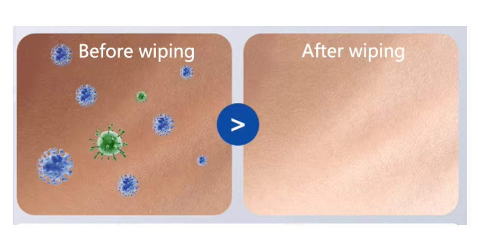 High Quality Factory Customization Sanitizing Wet Wipes small Alcohol Wipes Custom Sanitizers Wipes